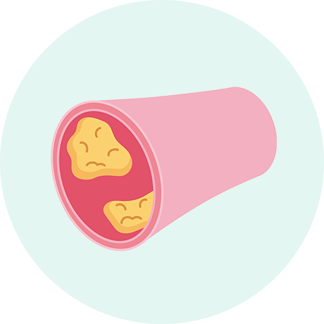 コレステロールを下げる